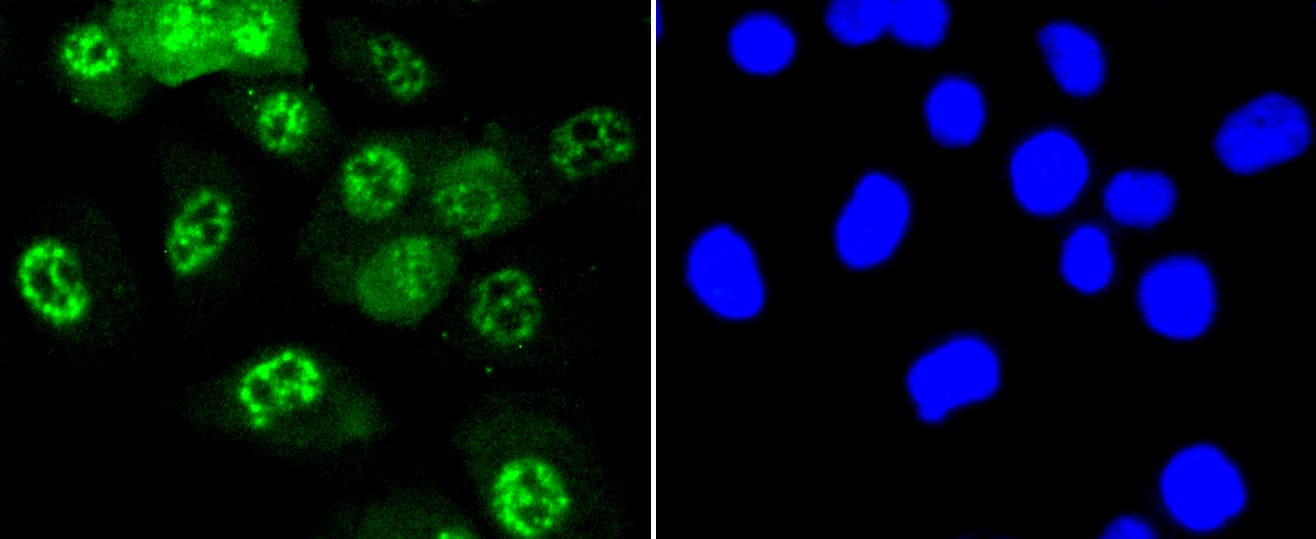 JNK1+2+3 Antibody (JNK1 phospho-Thr183 and JNK2 pThr183 and JNK3 pThr221)
