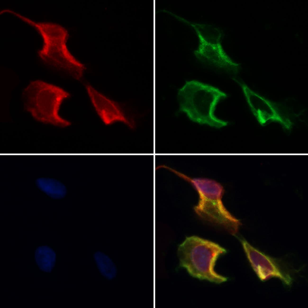 CCDC120 Antibody