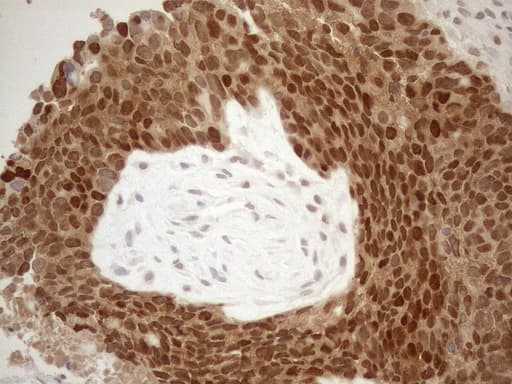 MGMT Antibody (clone OTI4F9)