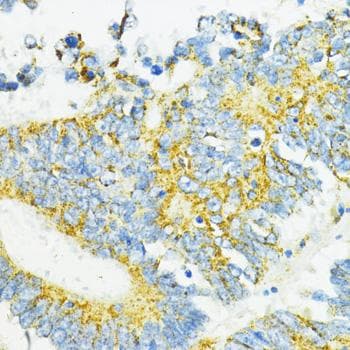 CD274 / B7-H1 / PD-L1 Antibody