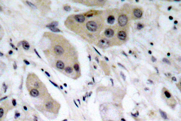AKT1 + AKT2 + AKT3 Antibody (phospho-Ser473)