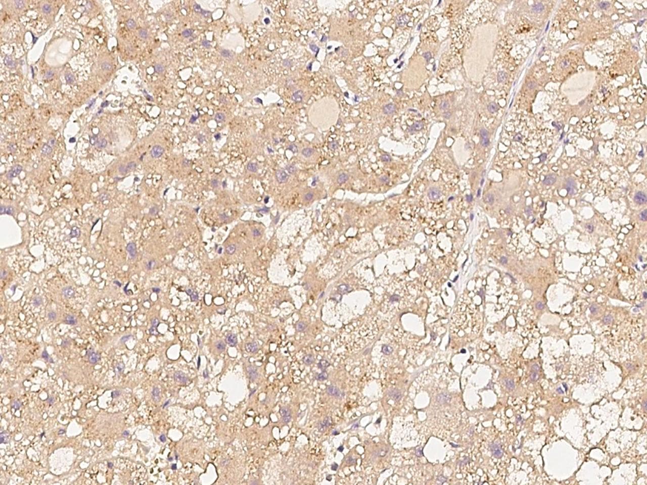 Chordin Antibody (Preservative Free)
