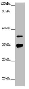 Polyclonal Rabbit anti-Human H2AFY / MACROH2A1 Antibody (IHC, WB)
