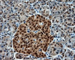 Monoclonal Mouse anti-Human PSMC3 Antibody (clone OTI1C10, IHC, IF, WB)