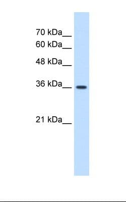 MAS1 / MAS Antibody (aa144-193)
