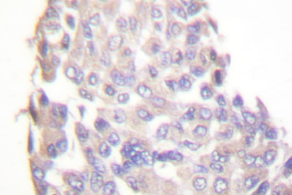 IKBKB / IKK2 / IKK Beta Antibody (Phe182)