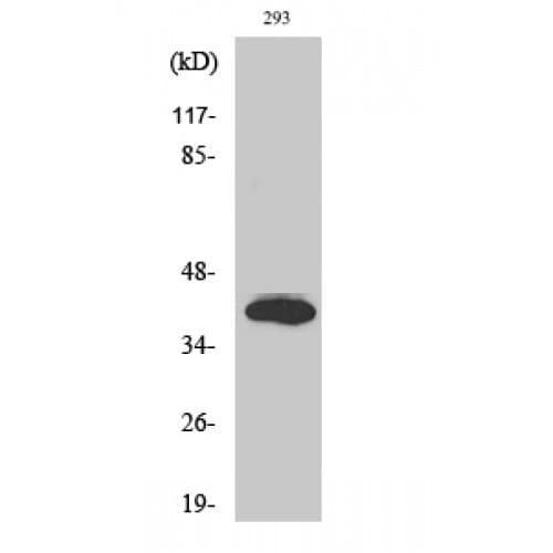 ISL2 / Islet 2 Antibody (130-210 aa, Internal)