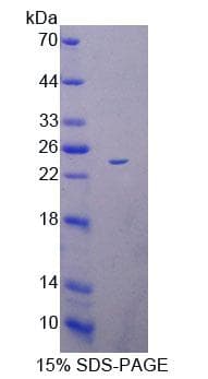 Mouse SCAD / ACADS Protein (Recombinant His-T7, N-terminus)