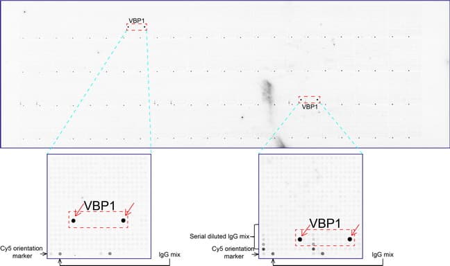 VBP1 Antibody (clone UMAB75)