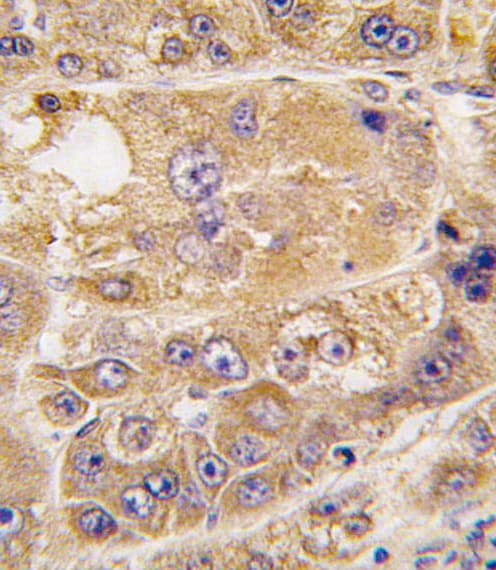 Polyclonal Rabbit anti-Human ARH / LDLRAP1 Antibody (aa277-306, IHC, WB)