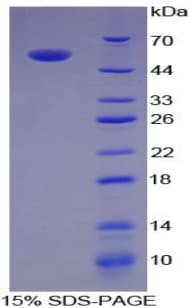 Human IL35 Protein (Recombinant His)