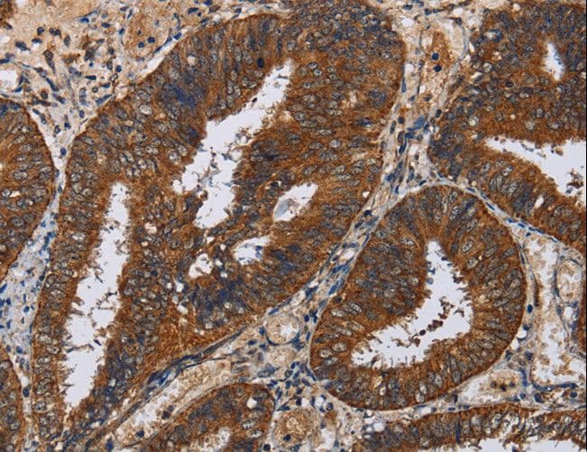 KLK11 / Kallikrein 11 Antibody