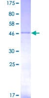 Human TWIST1 / TWIST Protein (Recombinant GST)