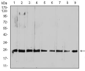 Monoclonal Mouse anti-Human RALA / RAL Antibody (clone 4G8C7, IHC, WB)