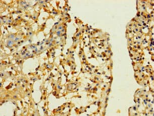 Polyclonal Rabbit anti-Human SLC25A40 Antibody