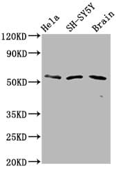 Polyclonal Rabbit anti-Human PHACTR1 Antibody (IHC, IF, WB)