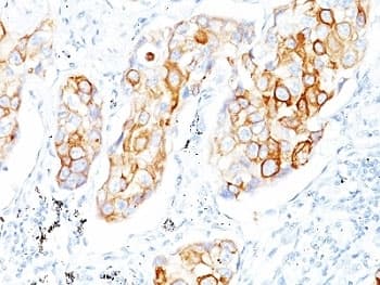 KRT7 / CK7 / Cytokeratin 7 Antibody (clone OV-TL12/30)