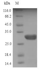 Mouse Angiogenin / ANG Protein (Recombinant 6His-SUMO, N-terminus)