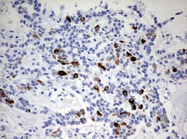Monoclonal Mouse anti-Human KRT20 / CK20 / Cytokeratin 20 Antibody (clone OTI3G1, IHC, WB)