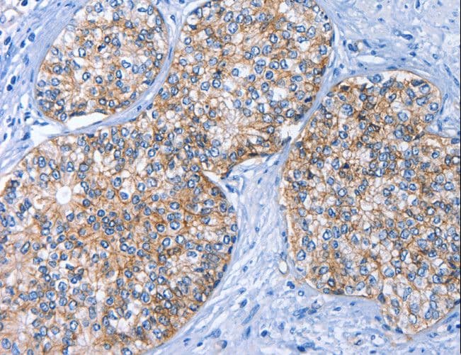 Polyclonal Rabbit anti-Human BCAM / CD239 Antibody (IHC, WB)