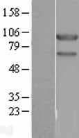 USP10 Protein (Over-Expression Lysate Myc-DDK (Flag))