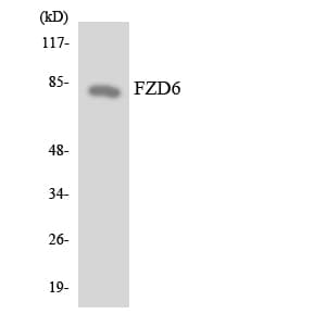 IHC-plus™ Polyclonal Rabbit anti-Human FZD6 / Frizzled 6 Antibody (aa108-157, IHC, WB)