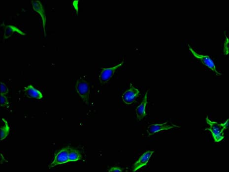 Polyclonal Rabbit anti-Human Hamartin / TSC1 Antibody (IHC, IF)