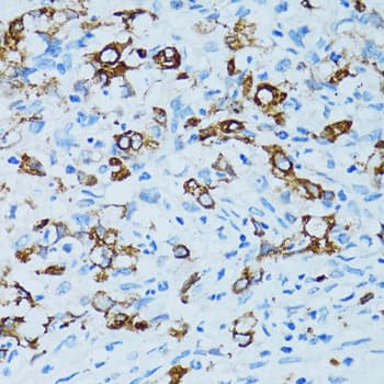 Polyclonal Rabbit anti-Human CTSE / Cathepsin E Antibody (IHC, IF, WB)