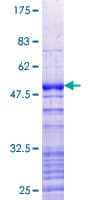 Human SREK1IP1 Protein (Recombinant GST)