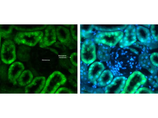 SLC2A2 / GLUT2 Antibody (C-Terminus)