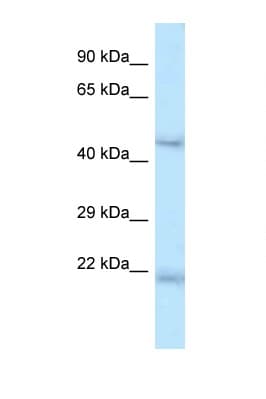 ONECUT1 / HNF6 Antibody (aa370-419)