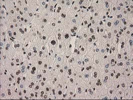 PYCRL Antibody (clone OTI3B9)