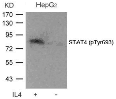 Polyclonal Rabbit anti-Human STAT4 Antibody (IHC, WB)