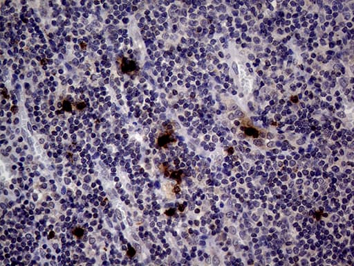 PRTN3 / Myeloblastin Antibody (aa28-248, clone OTI9C2)