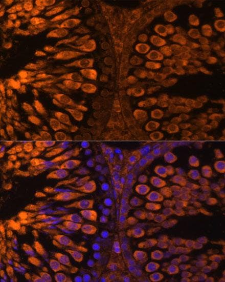 LDHC / Lactate Dehydrogenase C Antibody