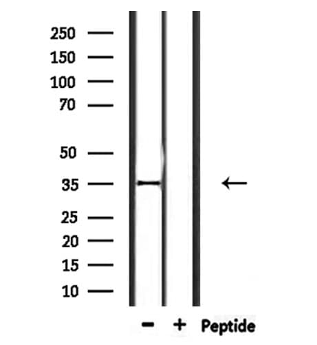 Polyclonal Rabbit anti-Human OR2L2 Antibody (WB)
