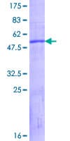 Human KLK9 / Kallikrein 9 Protein (Recombinant GST)