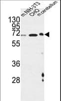 CREBL1 / ATF6B Antibody (aa560-589)