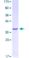 Human SAA2 / Serum Amyloid A2 Protein (Recombinant GST)