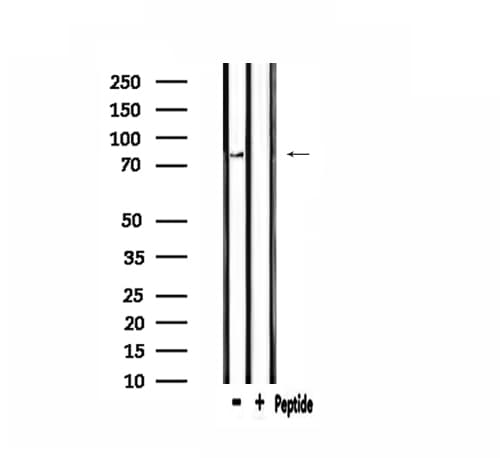 CPT1B Antibody