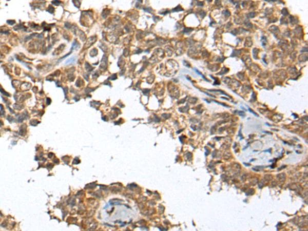 SPRTN / C1orf124 Antibody