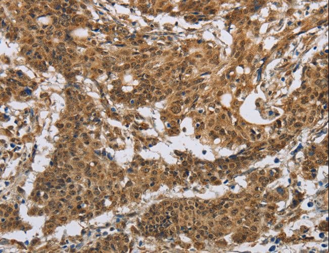 IL5RA / CD125 Antibody