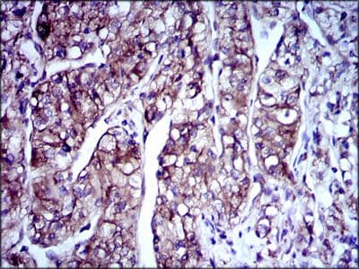Monoclonal Mouse anti-Human DCX / Doublecortin Antibody (clone 2G5, Amino Acid: 362-411, IHC, IF, WB)