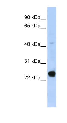 Polyclonal Rabbit anti-Human CFAP20 / GTL3 Antibody (aa71-120, WB)