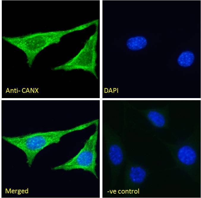 PathPlus™ Polyclonal Goat anti-Human CANX / Calnexin Antibody (aa200-250, IHC, IF, WB)