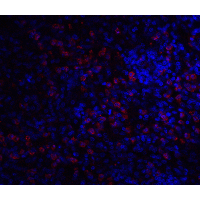 IHC-plus™ Polyclonal Rabbit anti-Human IRAK3 / IRAKM / IRAK-M Antibody (IHC, IF, WB)