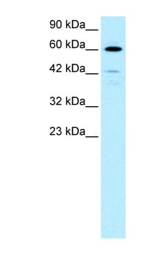HDAC2 Antibody (aa419-468)