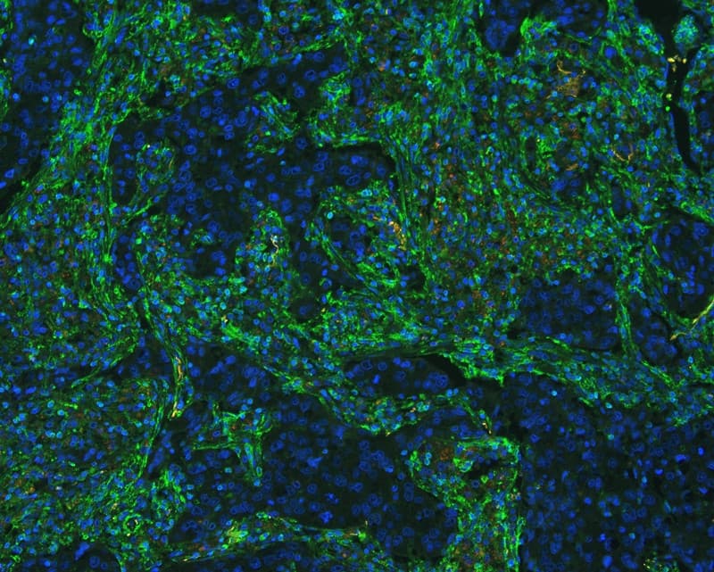 Polyclonal Rabbit anti-Human ANXA6/Annexin A6/Annexin VI Antibody (IHC, WB)