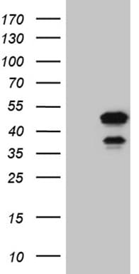 ELF3 / ESE1 Antibody (aa175-286, clone OTI9H7)