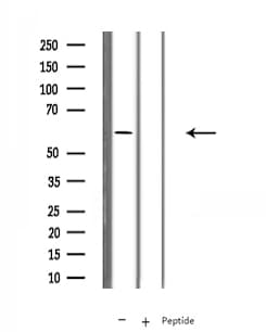 FBXW7 / FBW7 Antibody